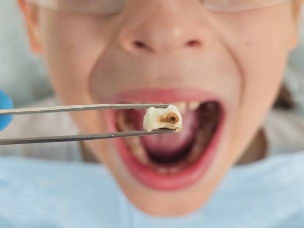 Best Dentist for Dental Trauma  in Vermilion, OH