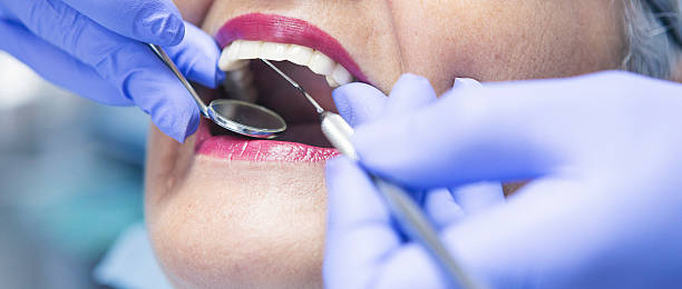 Best Broken Tooth Emergency  in Vermilion, OH